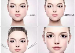 脸部下垂图片,面部松弛困扰？揭秘脸部下垂的成因与改善之道